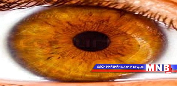 Хүүхэн харааны мэдээллийг сэргээх боломжтой