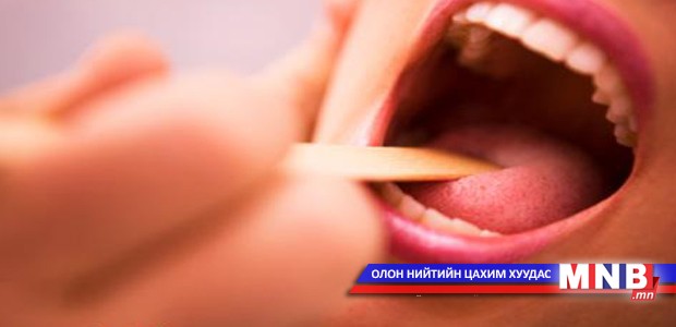 Хоолойны өвчнөөс хэрхэн сэргийлэх вэ?