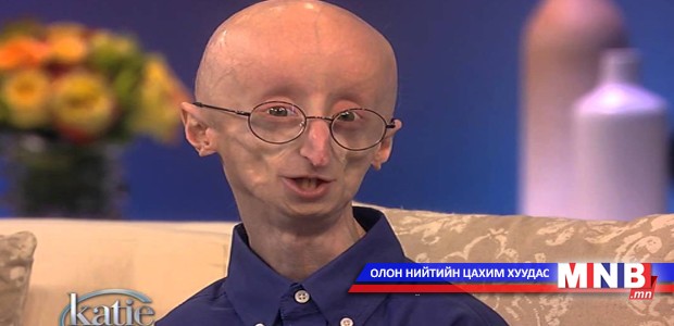 Хөгшрөлтийн өвчнөөр 17 настай хүү өөд болжээ