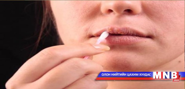 Вирус байнга хувирч өөрчлөгддөг
