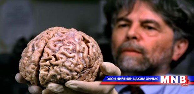 Зөнөх өвчинг эмчилдэг болжээ