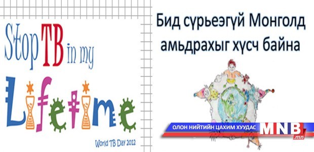 Өнөөдөр “Сүрьеэтэй тэмцэх дэлхийн өдөр”