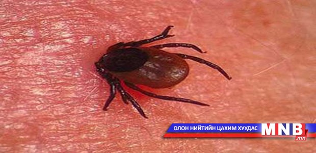 Хачигт хазуулсан иргэд эмнэлэгт хандаж байна