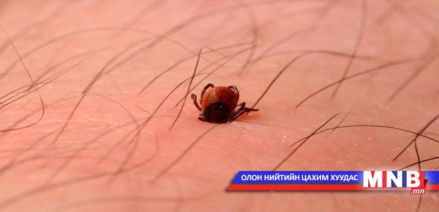 Хачигт халдвараас сэргийлье