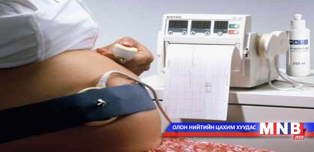 Ургийн зүрхний бичлэг хийлгэх шаардлагатай