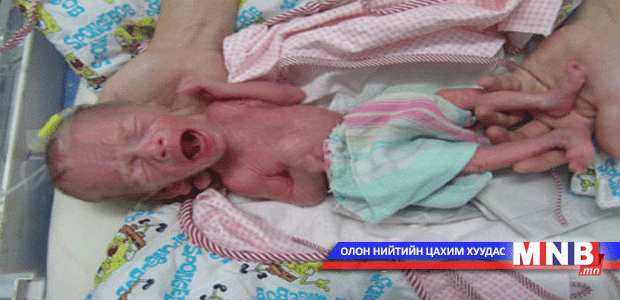 Гажигтай төрөлт ихсэх нь үндэсний аюулгүй байдалд нөлөөлнө