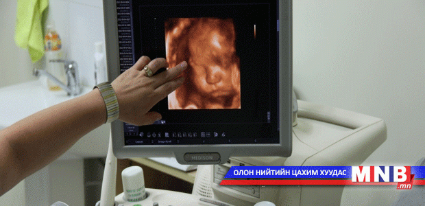 Хэт авиан шинжилгээнийхээ хариуг хэрхэн ойлгодог вэ?