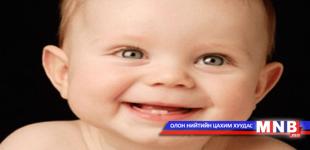 Хүүхдүүд зургаан сартайгаасаа эхлэн шүдний өвчлөлд өртдөг