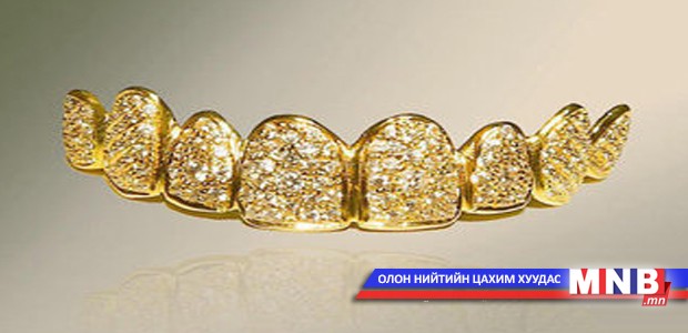 Дэлхийн хамгийн үнэтэй хиймэл шүдийг хийжээ