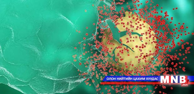 2030 он гэхэд ДОХ-ын халдварыг зогсоох боломжтой гэв