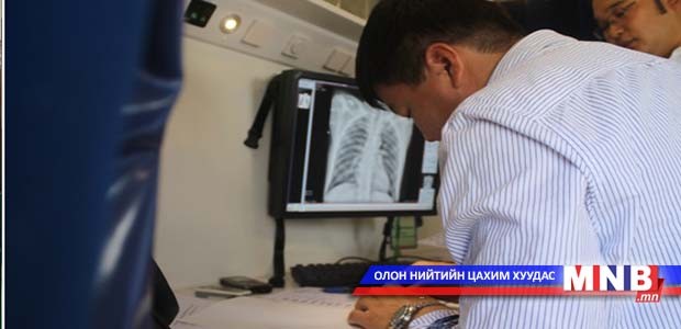 Сүрьеэгийн тархалтын судалгаа хийгдэж байна
