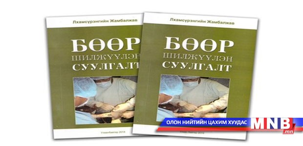 “Бөөр шилжүүлэн суулгалт” номын нээлт маргааш болно