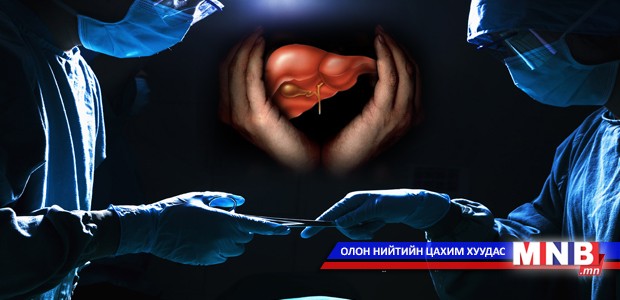 С вируст гепатит гэж юу вэ?