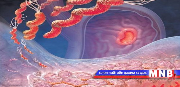 АНУ-д хүнсний шалтгаант халдвар гарчээ