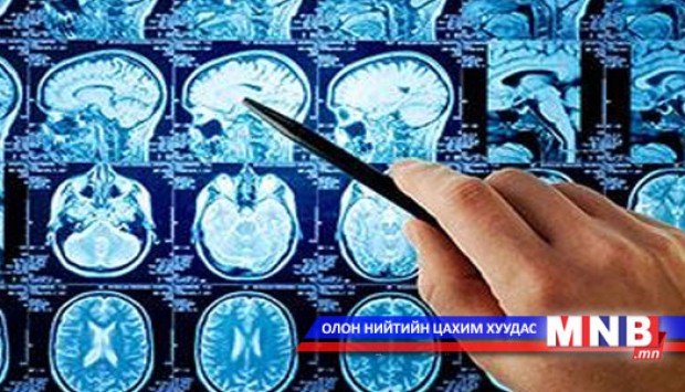 Татаж унах өвчинтэй тэмцэх өдөр тохиож байна