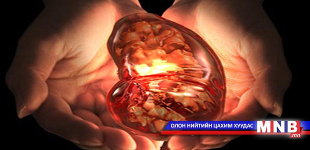 Усны хэмжээ багасах нь бөөрний өвчлөлд хүргэдэг