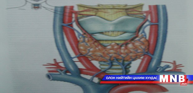 Бамбай булчирхайн эмгэг