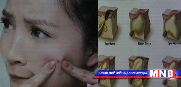 Батга