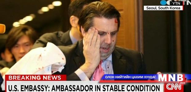АНУ-ын Элчин сайдын биед халджээ