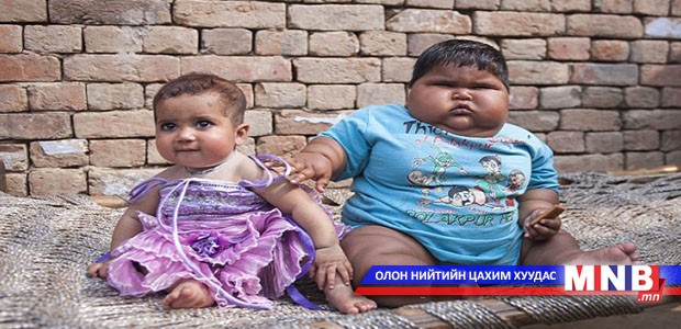 Дэлхийн хамгийн тарган хүүхэд 18 кг жинтэй, 10 сартай охин