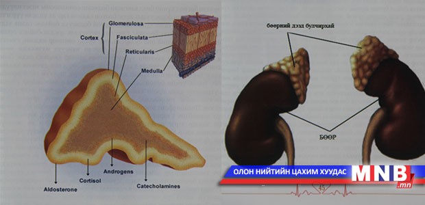 Бөөрний дээд булчирхайн эмгэг буюу Аддисоны өвчин