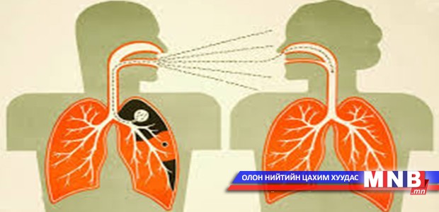 Сүрьеэ халдварт өвчний шалтгаантай нас баралтын нэгдүгээрт бичигдэж байна