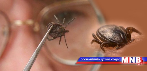Хачигт халдвараас урьдчилан сэргийлэхийг мэргэжлийнхэн санууллаа