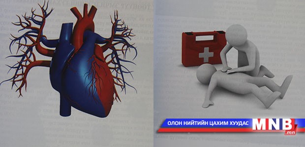 Зүрхэнд иллэг хийх