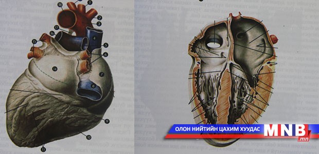 Зүрх гэнэт зогсох нь олон шалтгаантай
