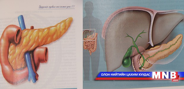 Нойр булчирхайн эмгэг