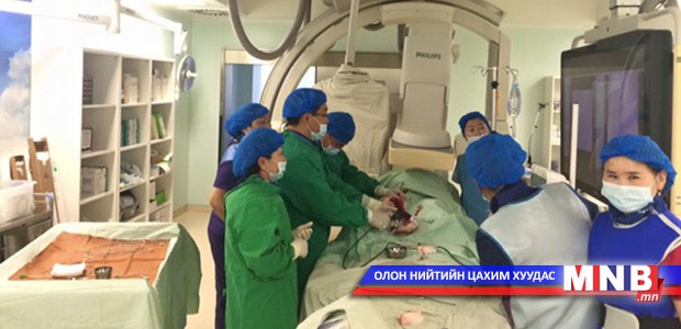 Бөөрний артерийн мэдрэлжүүлэлтийг анх удаа судсан дотуурх мэс заслаар түлж эмчилжээ