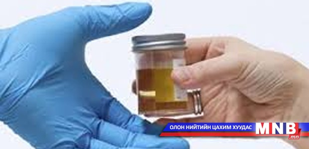 Шээсний иж бүрэн шинжилгээ авах оношлуур ирэх сараас өрхийн эмнэлгүүдэд хуваарилагдана