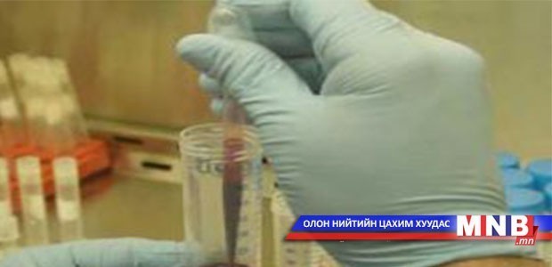 Багануурт хүний боом өвчин гараагүй