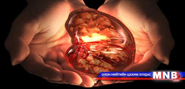 Дэлхийн 10 хүн тутмын нэг нь бөөрний өвчтэй байдаг