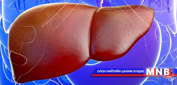 Гарын алга улайх нь элэгний хатуурлын шинж тэмдэг
