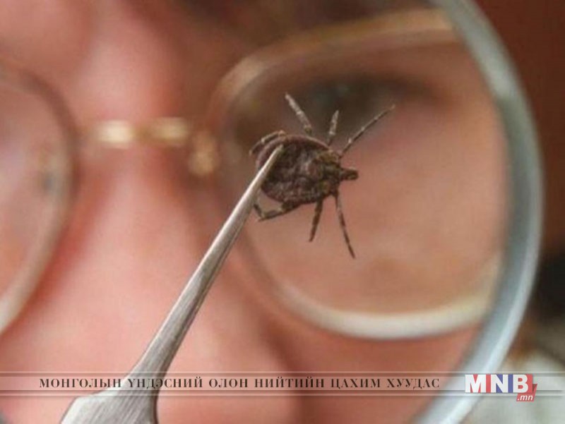 Хачигт халдварын эрсдэлд өртсөн 257 тохиолдол бүртгэгджээ