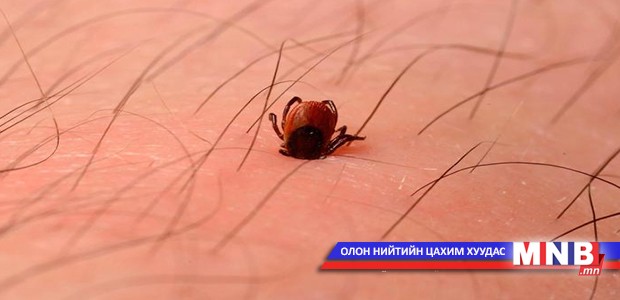 55 настай эмэгтэй хачигт хазуулан нас баржээ