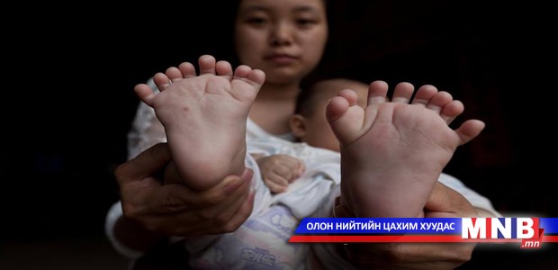 31 хуруутай бяцхан хүү