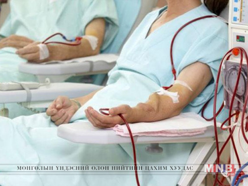 Бөөр орлуулах эмчилгээнд 154 иргэн үнэ төлбөргүй хамрагджээ