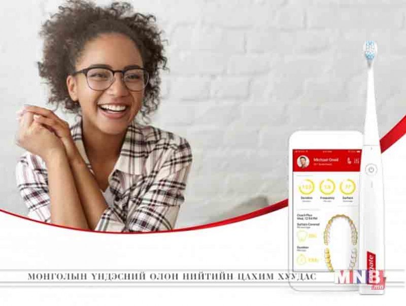 "Apple" компани өндөр технологийн ухаалаг шүдний сойз бүтээжээ