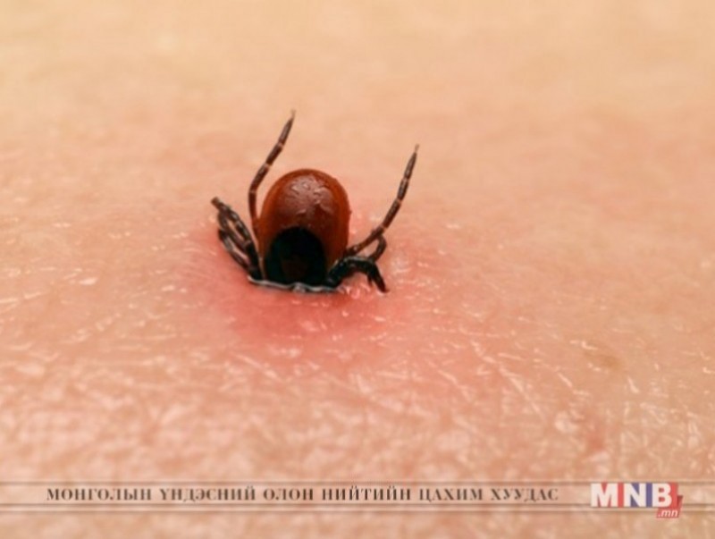 Хачгаар дамжих халдвар өмнөх оны мөн үеэс 13.9 хувиар бага байна
