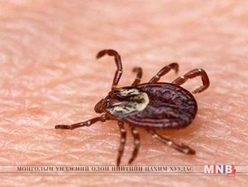 Хачигт халдвараас урьдчилан сэргийлэхийг зөвлөж байна