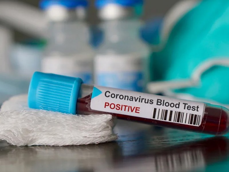 "COVID-19" халдварын тоо нэгээр нэмэгдэж, нийт батлагдсан тохиолдол 32 боллоо