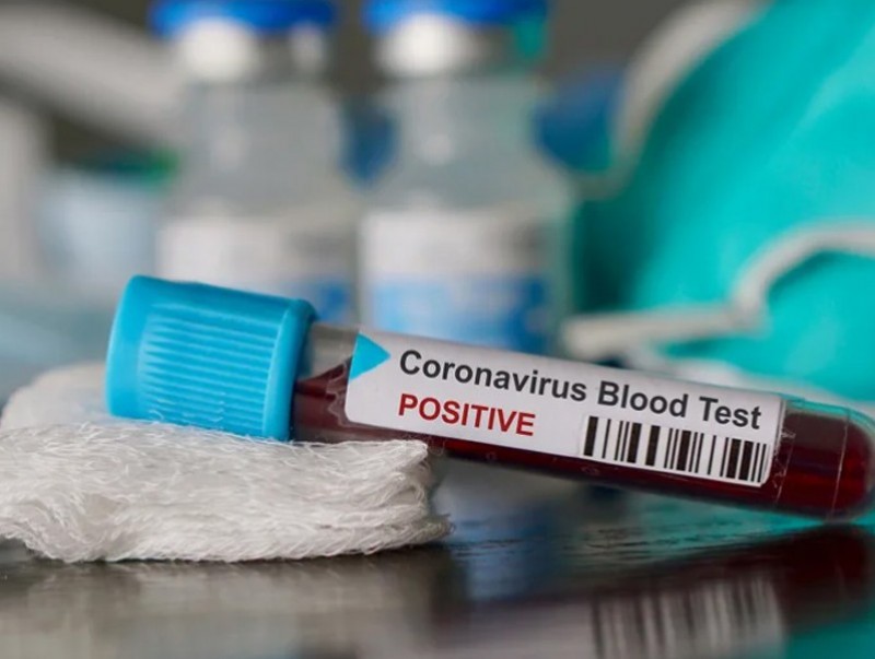 "COVID-19" халдварын тоо нэгээр нэмэгдэж, нийт батлагдсан тохиолдол 33 боллоо