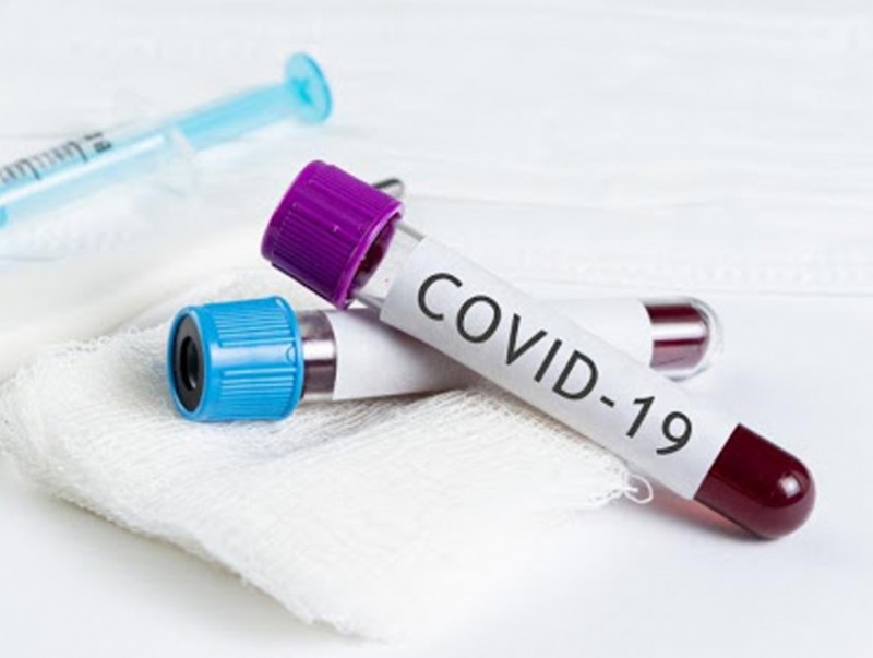 Монгол Улсад "COVID-19" халдварын нийт батлагдсан тохиолдол 135 боллоо
