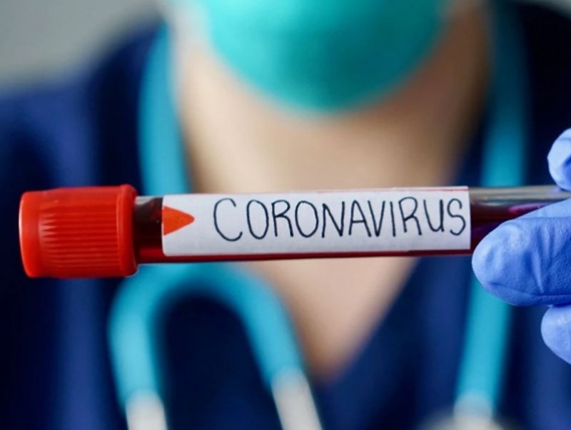Коронавируст халдвар "COVID-19"-ын Монгол дахь нөхцөл байдлын мэдээлэл