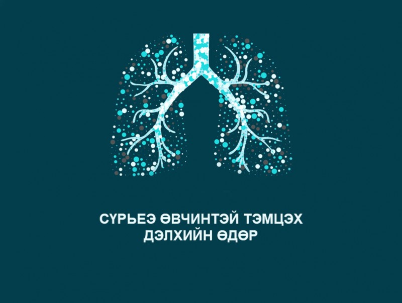 ӨНӨӨДӨР: “Сүрьеэтэй тэмцэх дэлхийн өдөр"