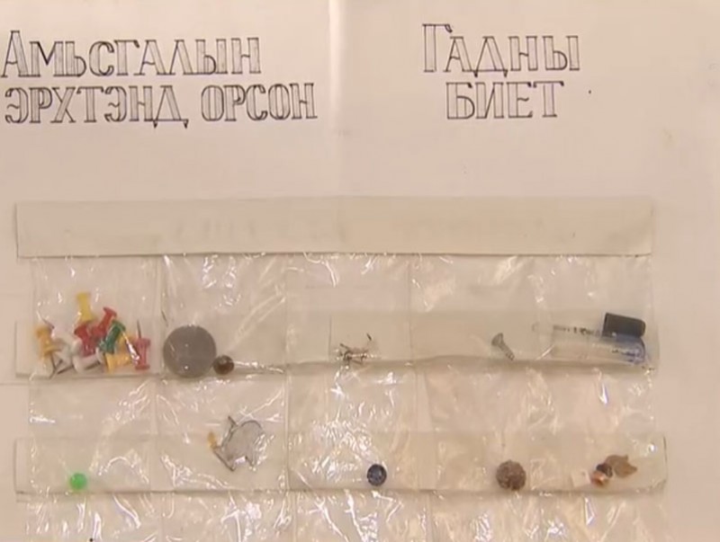 ЭХЭМҮТ-д 5 жилийн хугацаанд 400 орчим хүүхэд гадны биет залгиж хэвтэн эмчлүүлжээ