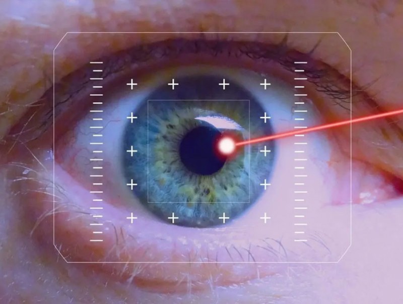 "Smart lasik" хараа засах мэс засал нь хамгийн хурдан, бага зүсэлттэй гэдгээрээ давуу талтай