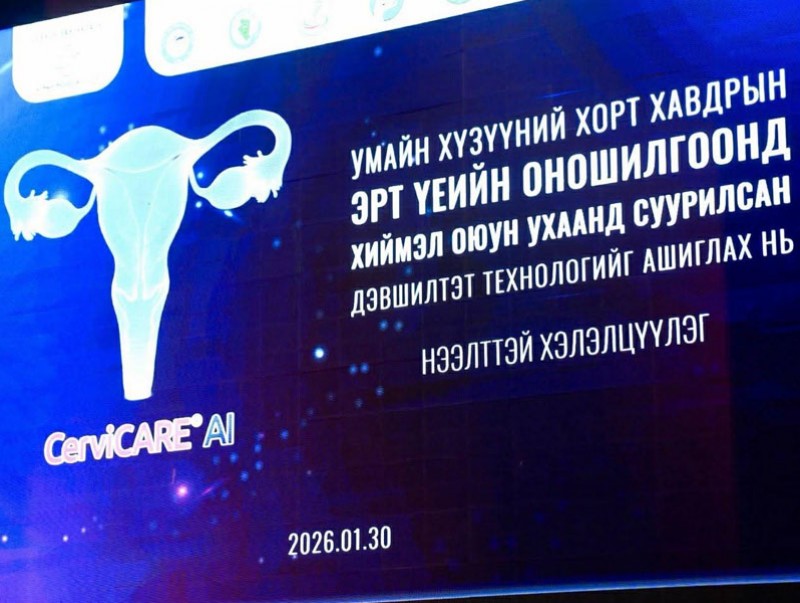 Умайн хүзүүний хавдрын эрт илрүүлгийг таван секундийн дотор хийж байна